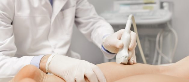 Varicenter, tratamiento de varices en Alicante