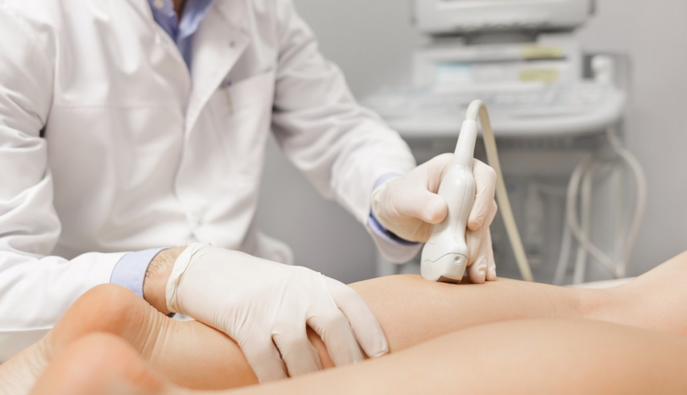 Varicenter, tratamiento de varices en Alicante